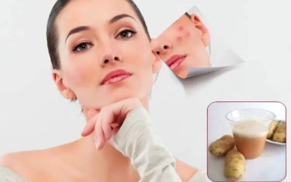 Potato For Clear Skin – Natural Gift For Youthful Face